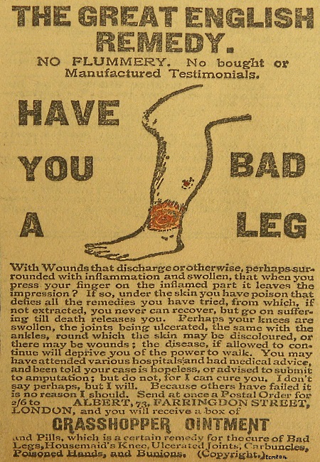 A bad Leg in 1907.