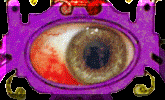 A Bloodshot Eye.