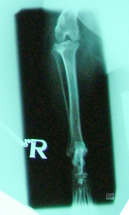 X-ray charlie